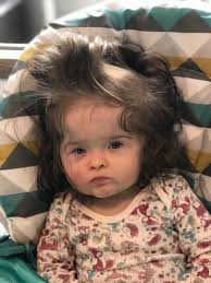 Some people think that if your baby has a lot of hair, this could be what's causing pregnancy heartburn. 11 Month Old Baby With Rapunzel Hair Has More Hair Than You Baby Born With So Much Hair People Think She S Wearing A Wig