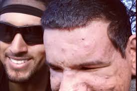 Fundraiser by Emmanuel Limaco : Please Donate to Support the Limaco Family