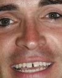 Matt Conner (Actor, Composer): Credits, Bio, News & More