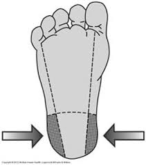 Image result for Capillary Puncture