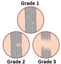And start your road to full recovery. Knee Sprain Symptoms Diagnosis Treatment Knee Pain Explained