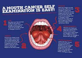 Doctors call this a local recurrence. An Introduction To Oral Cancer Dental Supplies And Equipment Dentaltix