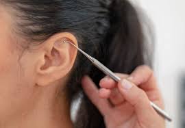Maybe you would like to learn more about one of these? Do Ear Seeds Or Auricular Therapy Work For Anxiety I Tried It