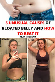 Pin On Alternative Health