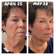 I just want to put Neo-FILLER