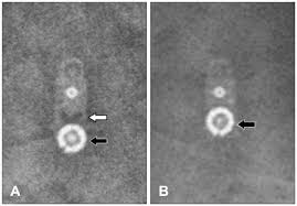 For more information, contact your codman sales representative. Xmlinkhub