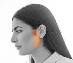 Get your facts right on sideburns women. Sideburns Laser Hair Removal Nyc
