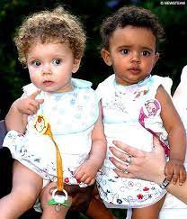Million To One Black And White Twins Celebrate First Birthday Biracial Twins Twins Twin Girls
