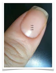 Maybe you would like to learn more about one of these? Clear Fingernails Is It A Bad Thing Nail Care Hq
