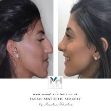 Manolis Heliotis added a new photo.