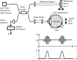 Dear all, please explain how 33 zone metal detector using pulse induction technology work. Optical Coherence Tomography Oct Principle And Technical Realization Springerlink