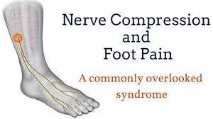 Every step we take places a force 1.5x body weight through our feet. Top Of The Foot Pain And Swelling Treatment