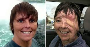 How can you survive with one eye …👁️ 📸: Jenisha Aggarwal