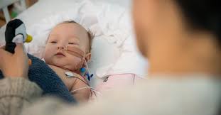 Image result for Infant Botulism