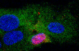Related viruses are found in woodchucks, ground squirrels, tree squirrels, peking ducks, and herons. Paul Ehrlich Institut Pressemitteilungen Der Tarnung Des Hepatitis B Virus Auf Der Spur
