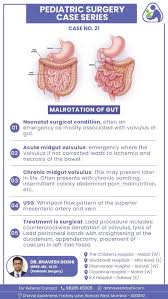 Image result for Midgut Volvulus
