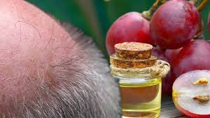 It is also very light, almost as light as jojoba oil. Hair Loss Treatment Grapeseed Oil Shown To Cause Significant Hair Growth How To Use Opera News