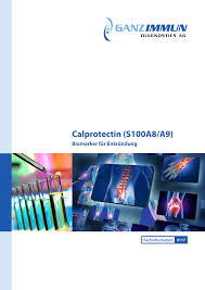 Stark erhöhte werte kommen bei chronisch entzündlichen darmerkrankungen, wie. Pdf Calprotectin S100a8 A9 Biomarker Fur Entzundung