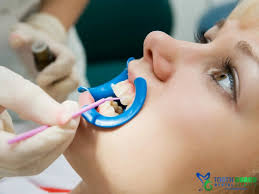 Image result for Jaw Dislocation