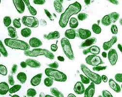 Image result for Q Fever