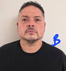 Ezgel under eye treatment before and after pictures