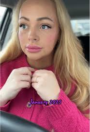 My Mounjaro Journey: 50kg Weight Loss Transformation