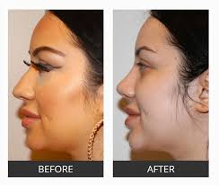 Dr. Roger Tsai Spotlight