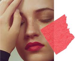 Entdecke rezepte, einrichtungsideen, stilinterpretationen und andere ideen zum ausprobieren. Cold Comfort Innovative Rosacea Treatments To Keep Your Skin Calm This Winter Vogue
