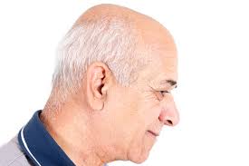 56.000+ Cabezas Calvas Fotografías de stock, fotos e imágenes libres de  derechos