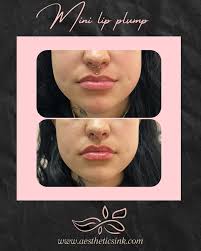 Aesthetics Ink: Becky Potts-Klinzing, RN (@aesthetics_ink) • Instagram  photos and videos