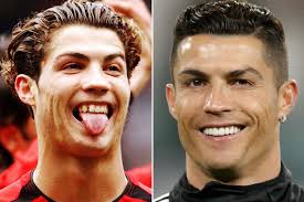 Cristiano ronaldo is a professional soccer player who has set records while playing for the cristiano ronaldo dos santos aveiro is a portuguese soccer superstar. As Simon Cowell Shows Off Gleaming Teeth Other Celebs Who Ve Transformed Their Smile Mirror Online