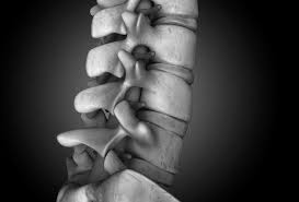 Spine Surgery For Compression Fractures Austin Tx