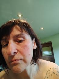 New tattoo with no red skin reaction