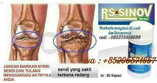 Maybe you would like to learn more about one of these? Cara Mengobati Bengkak Di Lutut Ayam Harga Ulasan Bahan Komposisi