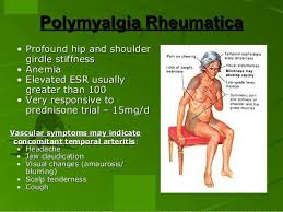 Polymyalgia Polymyalgia Rheumatica Diet Polymyalgia Rheumatica Simply Health