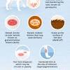 When the prostate gland becomes enlarged it presses against the wall of the urethra (the tube which connects the bladder to the outside of the dog), making it very difficult for your dog to urinate. 1