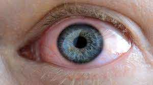 Rayhaber Panosundaki Pin