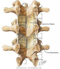 Maybe you would like to learn more about one of these? Ligamentum Flavum