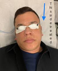 BAIRE-Hair Removal, Lashes,Brows,Facials