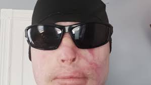 Fundraiser by Michael Targouski : Stand with Michael: 10 Months in Hospital