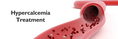 Image result for Hypercalcemia