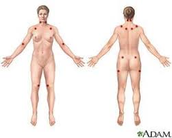 Image result for Trigger Point Location