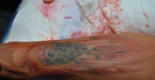 At least it should be in this way, considering it's a design that is going to be on your own body for the pretty long time. Meteor Tattoo On Many Pacquiao S Left Inner Foream
