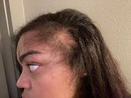 The pure fear of almost dying by a hair -