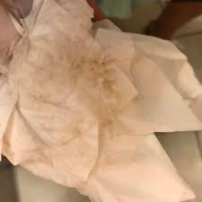 Coffee ground discharge early pregnancy. Tmi Brownish Discharge Glow Community