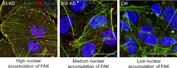 We did not find results for: Nup93 Regulates Breast Tumor Growth By Modulating Cell Proliferation And Actin Cytoskeleton Remodeling Life Science Alliance