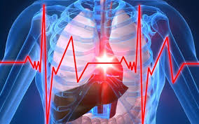 Imagini pentru infarct miocardic