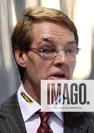 Trainer Pierre Page (Eisbären Berlin) mit blauem Auge Eishockey DEL Herren  Deutsche Eishockey Liga