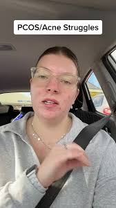 Dealing with PCOS and Acne