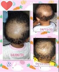 Because of this, it is best to use hair wraps, hats, scarves, pillowcases, etc. 5 Best Hair Products For Toddlers With Dry Hair